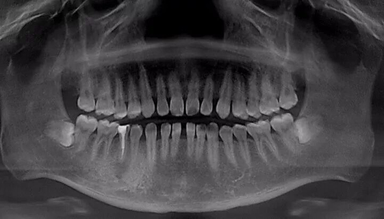 1512024281553188.jpg 1512024281553188.jpg